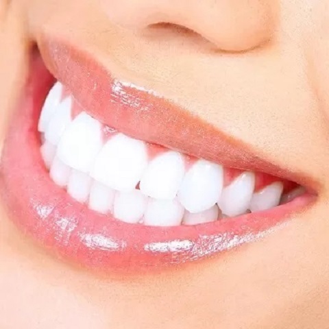 Laser teeth whitening treatment in Islamabad