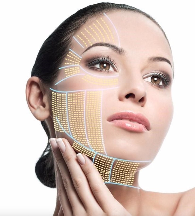 HIFU Treatment in Islamabad